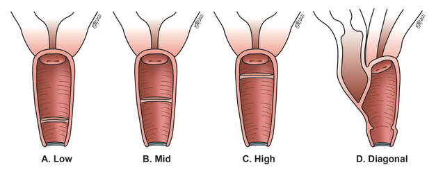 images showing anomalies of the vagina